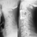 Spine Surgery Hospitals in Ahmedabad